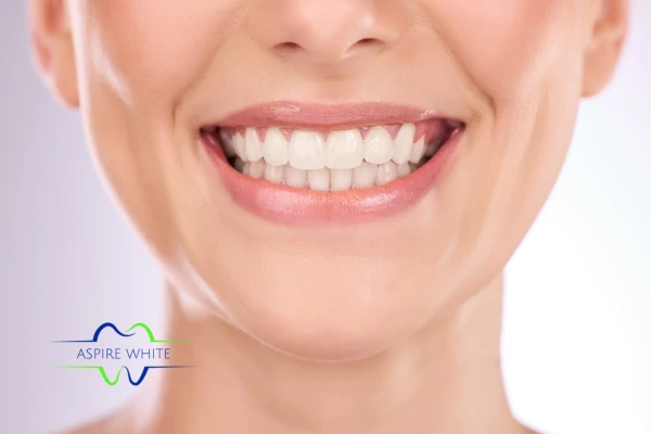 Follow your teeth whitening aftercare Bexley to prolong your whiter smile!