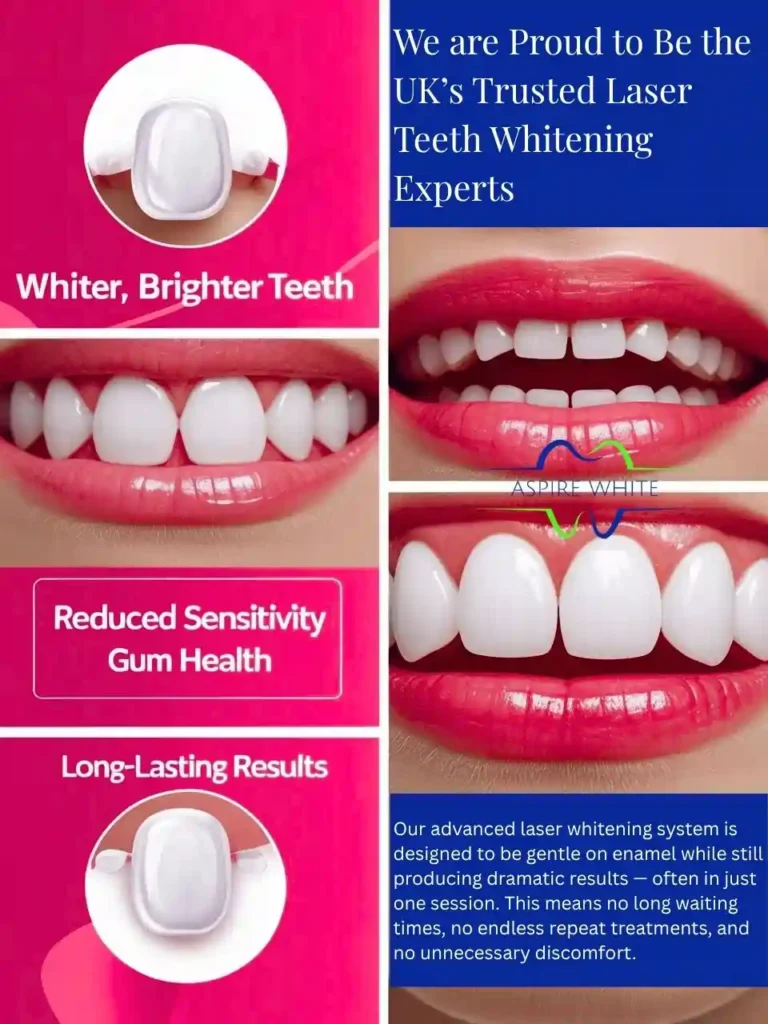 We are Proud to Be the UK’s Trusted Laser Teeth Whitening Experts Bexley